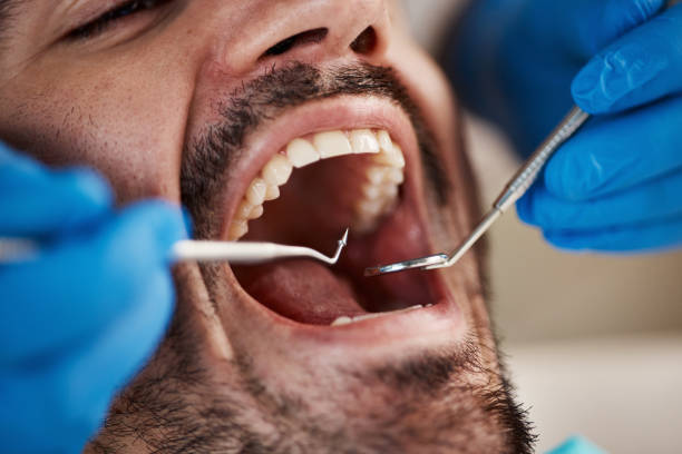 Best Urgent Tooth Repair  in Beechwood, MS