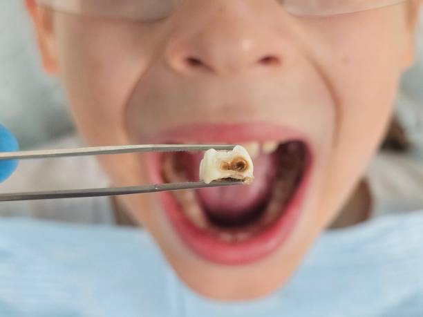 Best Emergency Dentist for Kids  in Beechwood, MS